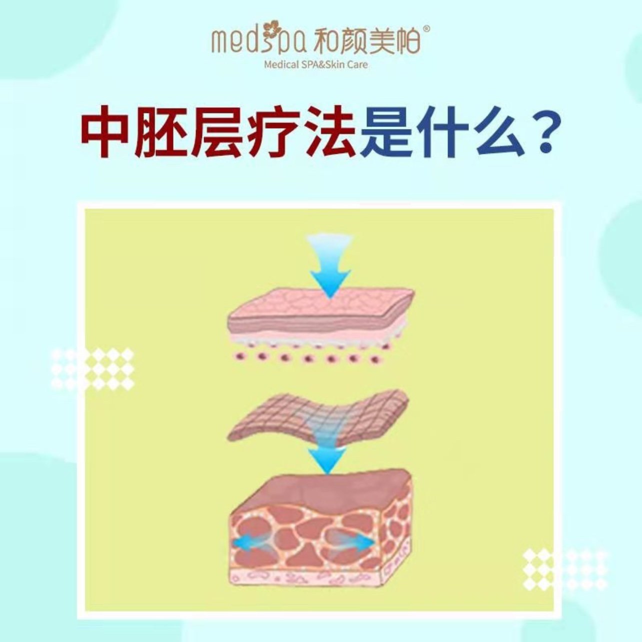 中胚层疗法是什么?