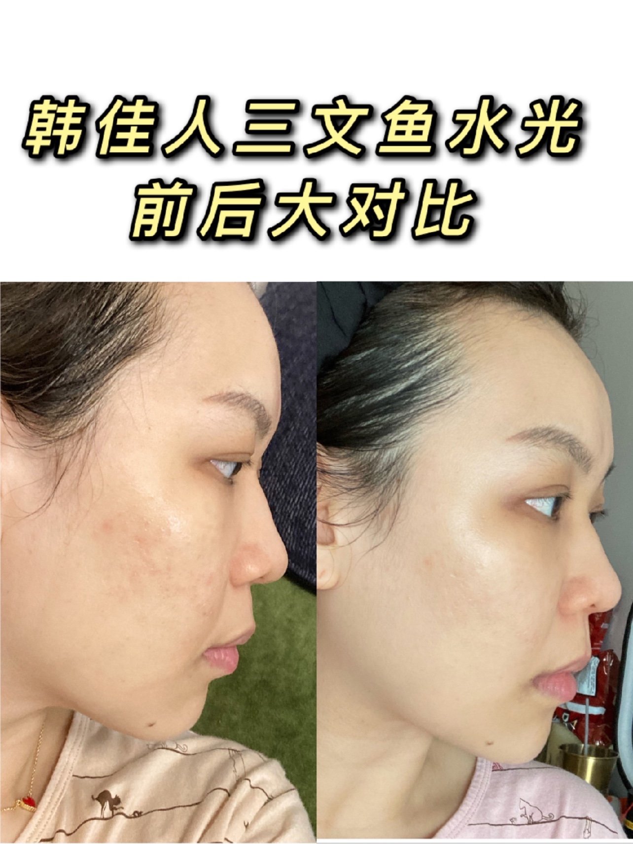 新氧试用官韩佳人三文鱼微水光
