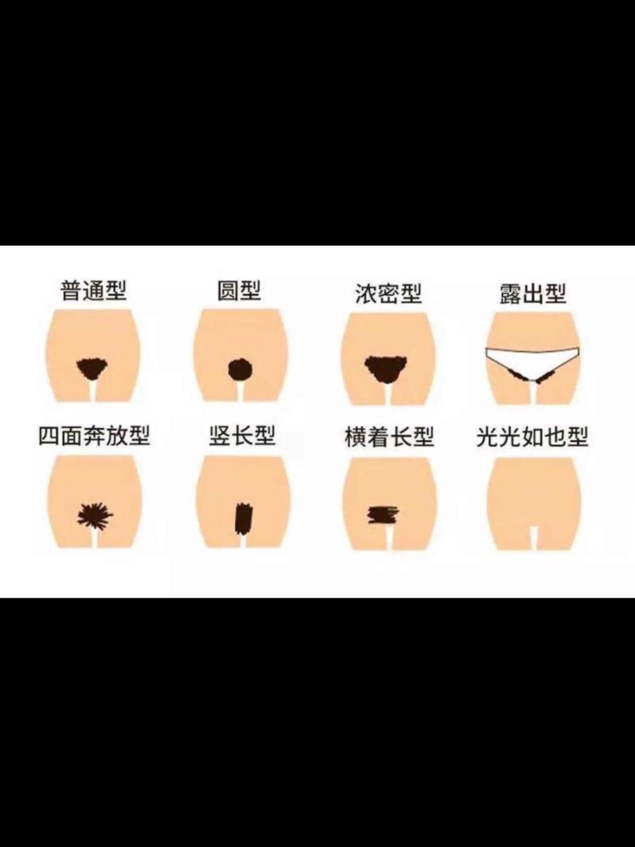 疾病的症状,下面就让我们一起来探讨为什么有的女性私处毛发这么浓密