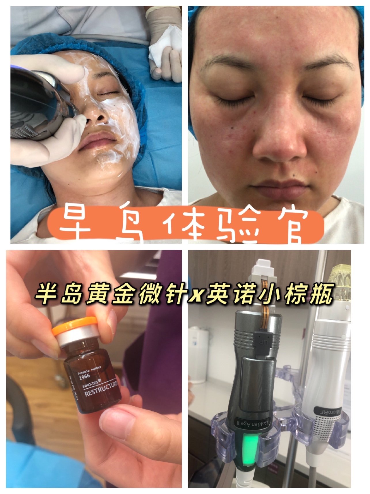 妈呀~没想到这次早鸟体验官竟然选中我了~而且还是价_圈子-新氧美容整