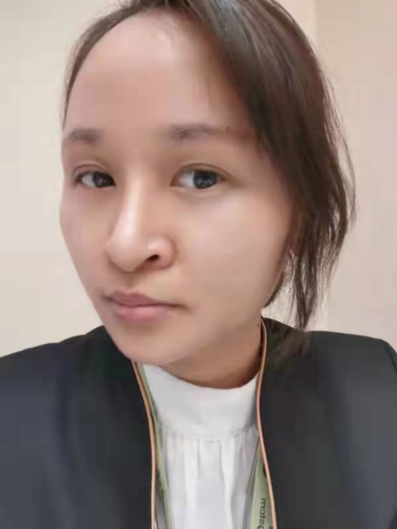改善眉型,眼皮松弛,皱纹 提升双眼皮眼睑 年轻化提眉