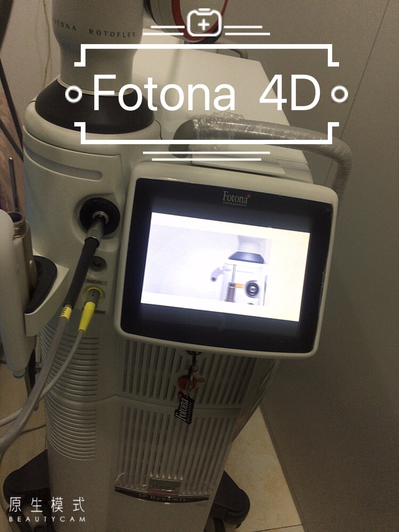 新氧体验官fotona4d