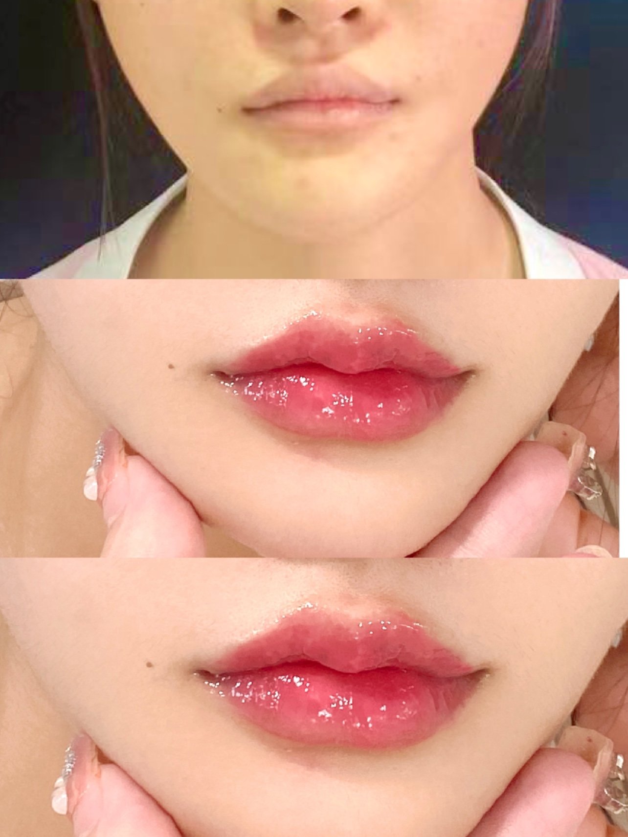 微m唇综合,微笑唇,嘟嘟唇,你更适合哪个唇型呢?
