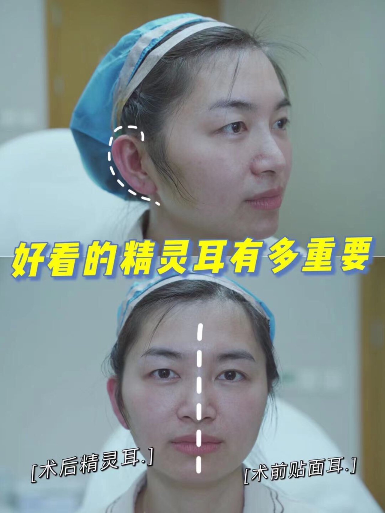 精灵耳|做完真的太显脸小了