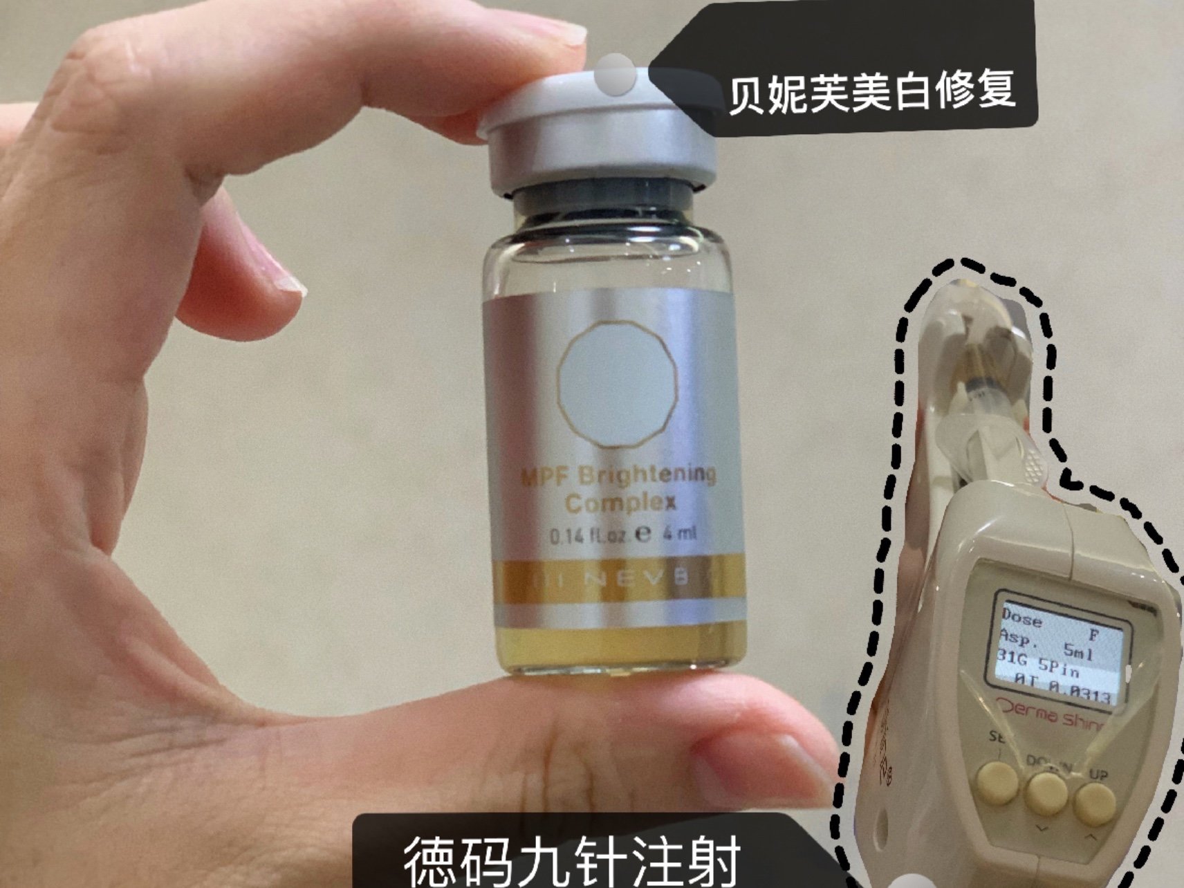 中了贝妮芙m22超水光联合09体验机购是深圳非凡医疗美容医院出了