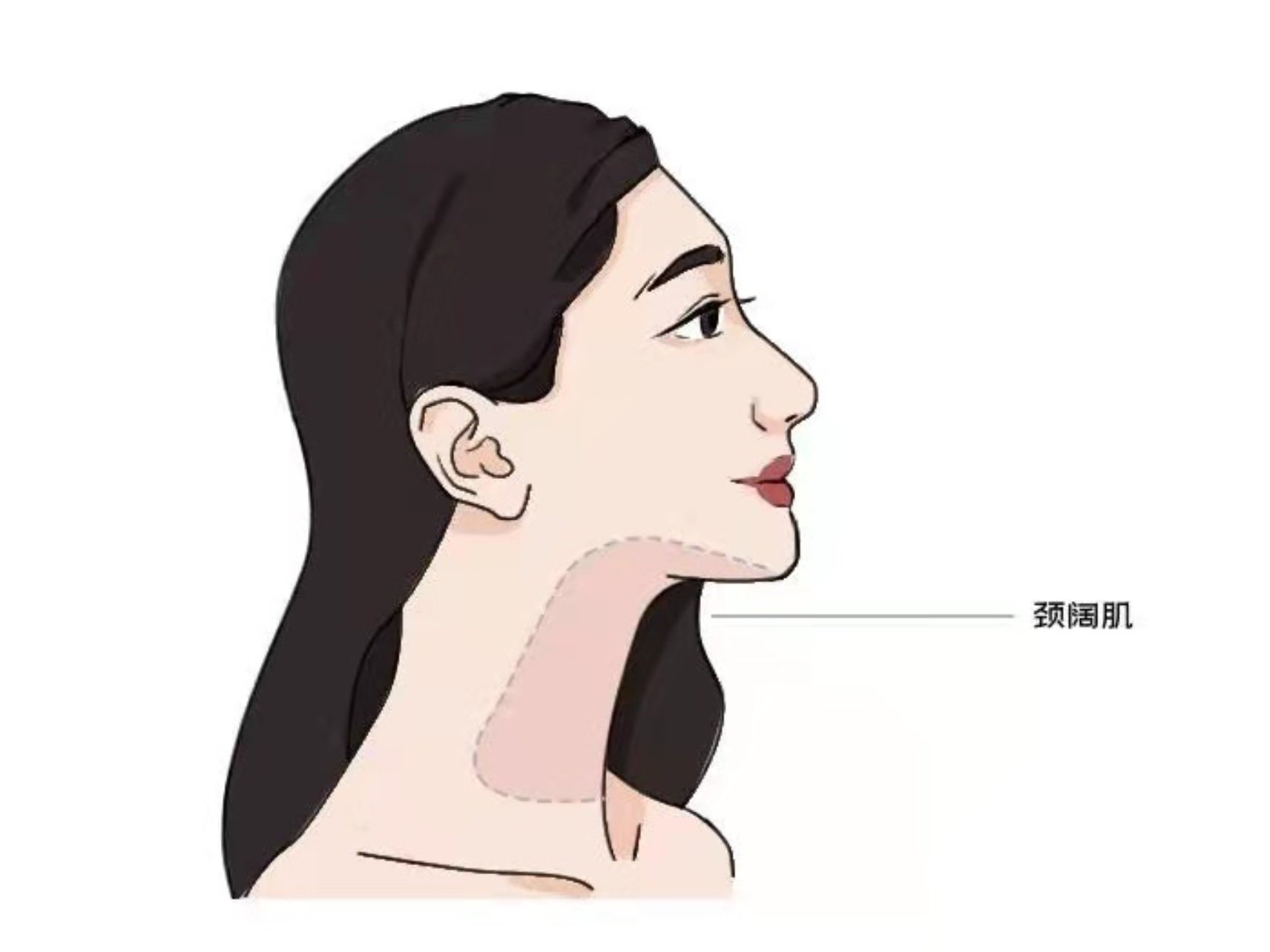 下颌线与脖子交汇的地方的肌肉,叫颈阔肌.