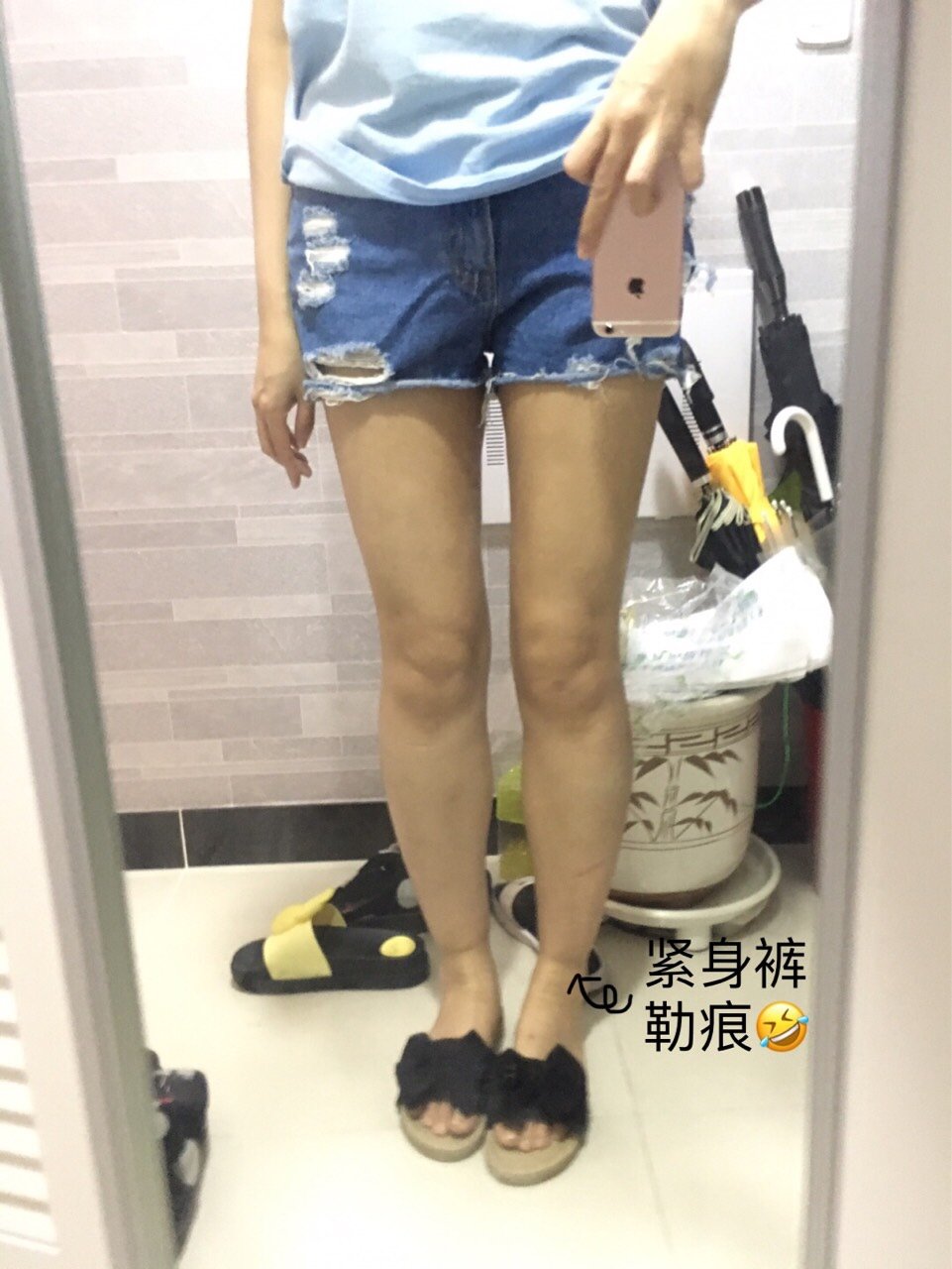 【吸脂】大腿 ,【大腿环吸】无死角/大容量/术后紧致不凹凸/韩国客人