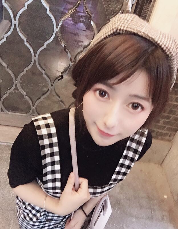 【眼部多项】【全眼整形】美杜莎双眼皮=切开避开血管