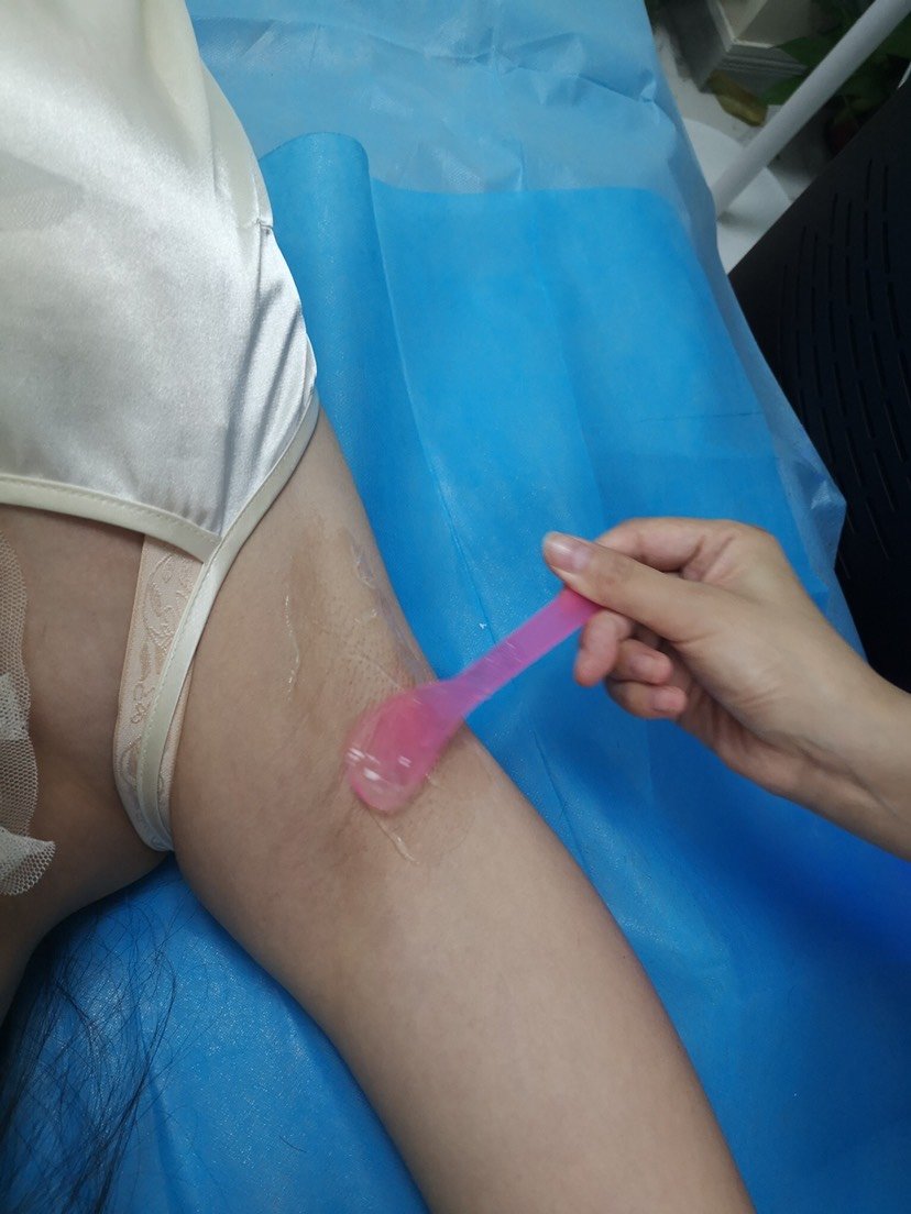 【66双眼皮节】【激光脱毛】比基尼线脱毛 1次 ,【24年口碑机构】超冰