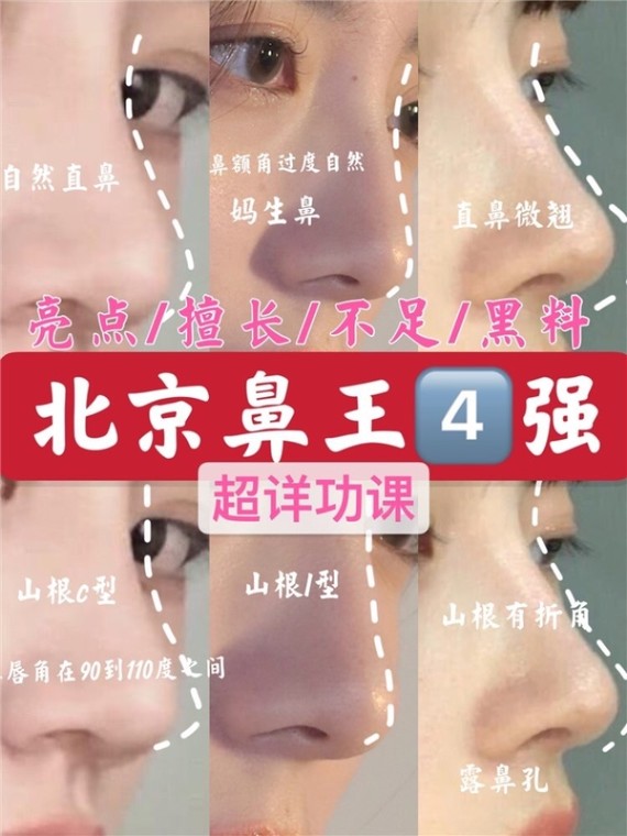 北京鼻王医生top4谁最厉害你想了解谁63