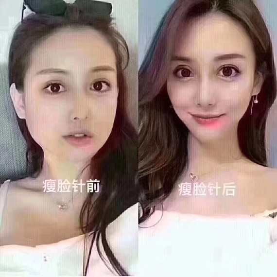 列举下网红脸的几个特点