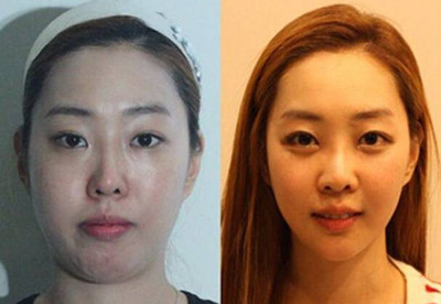 神奇的整形案例对比图 绝对亮瞎你的双眼