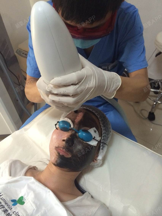 港口区HLumenisclinic美容外科碳粉激光爆破黑