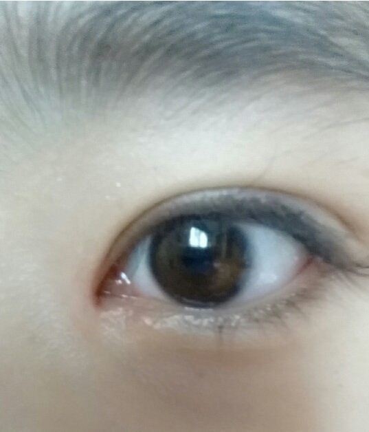 切开重睑术 开前眼角 鼻尖 鼻梁 6个月后的照片