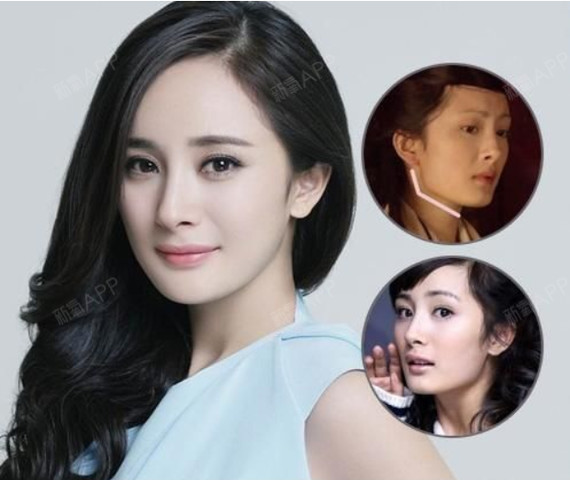辨别真假,6招看穿是不是整容脸(以明星为_圈子-新氧