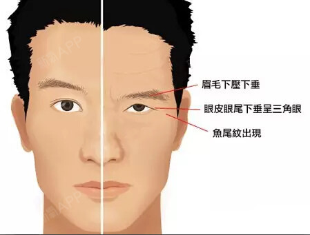 【北京高恩世上:"流光容易把人抛,垂了眉毛,耷拉眼角"拯救三角眼危机