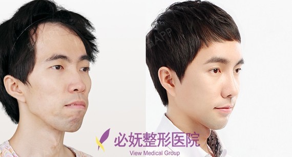 香港有个男明星 是龅牙 蘑菇头 齐刘海 演了好多喜剧