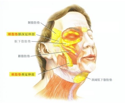 颊脂垫是衬托在中颊区位置的