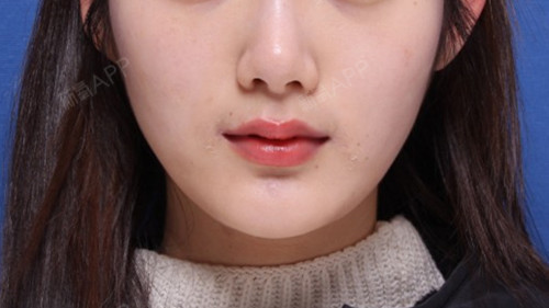 长得像赵丽颖的美女,由于嘴角线条向下给人不亲和的印象,想到要做