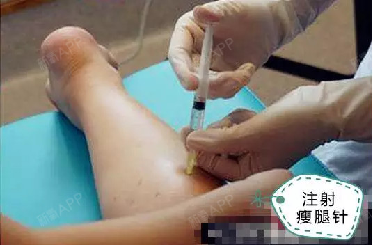 图解瘦腿针注射全过程一、哪些人适合注射瘦_圈子-新氧美容整形