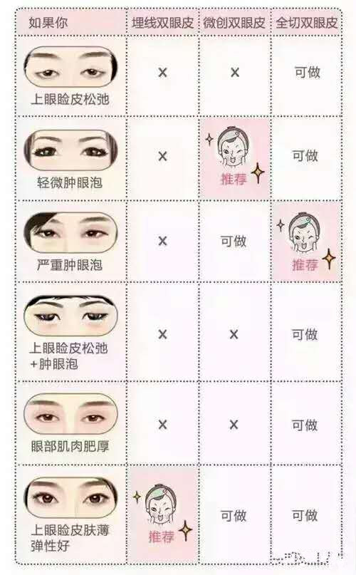 4,一个眼是双眼皮,而另一个眼是单眼皮,可不可以只做一个呢?