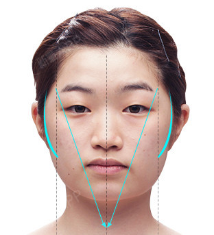侧颧骨凸出脸型的特征 侧颧骨的凸出现象比较显眼的情况下, 从正面上