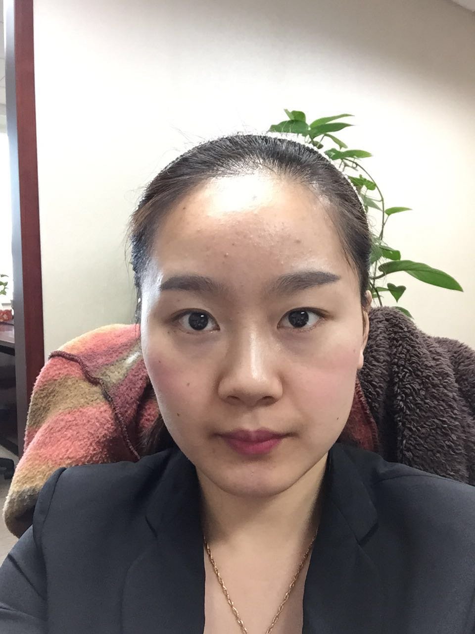 【北京杨仁宝医生免费双眼皮手术】胖脸妹纸还有双死鱼眼
