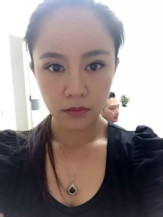 隆胸手术后两个月,效果非常自然,当然,付出就有收获,娱乐圈本就是看胸