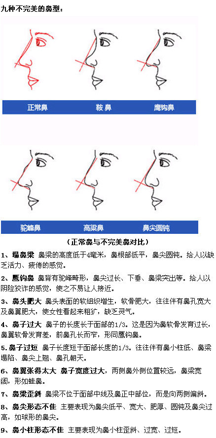 【韩国the整形外科】带您看看九种不完美的鼻型.