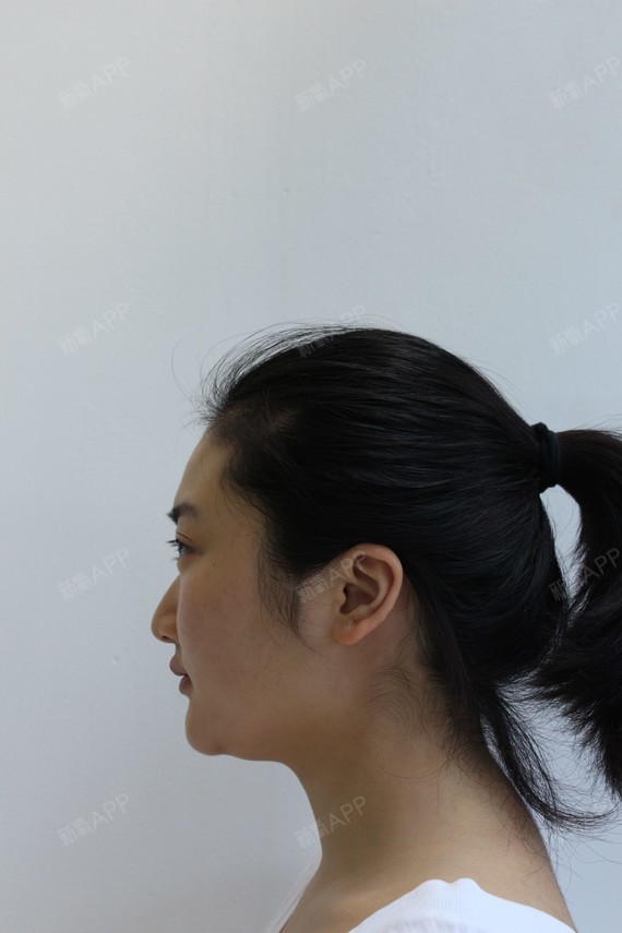 侧面可以明显看出 双下巴特别严重!