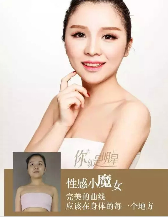 新氧- 杭州艺星医疗美容医院 | 术后当自强 | 吸脂瘦腹部