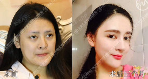 大连明医汇整形美容(鼻子专修机构)鼻综合第0
