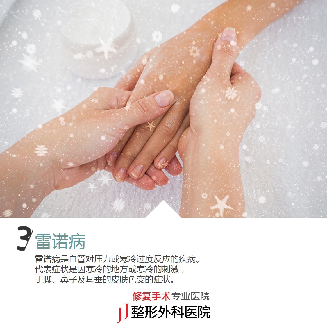 第三是雷诺病.