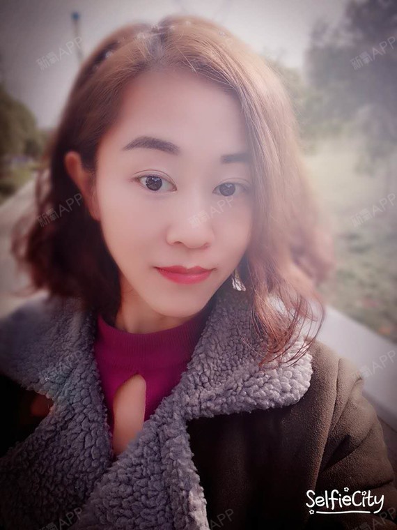 给大家看看我的双眼皮,现在恢复的好好,都看不到做的线了
