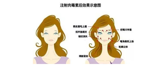 抬头纹,鱼尾纹,表情纹.该拿什么拯救你?