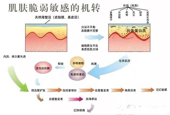 皮肤换季就敏感?你可知道还细分干性过敏?油