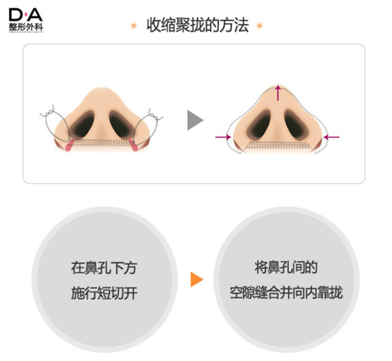 鼻子的形状能左右整个脸部,可见鼻部的重要性