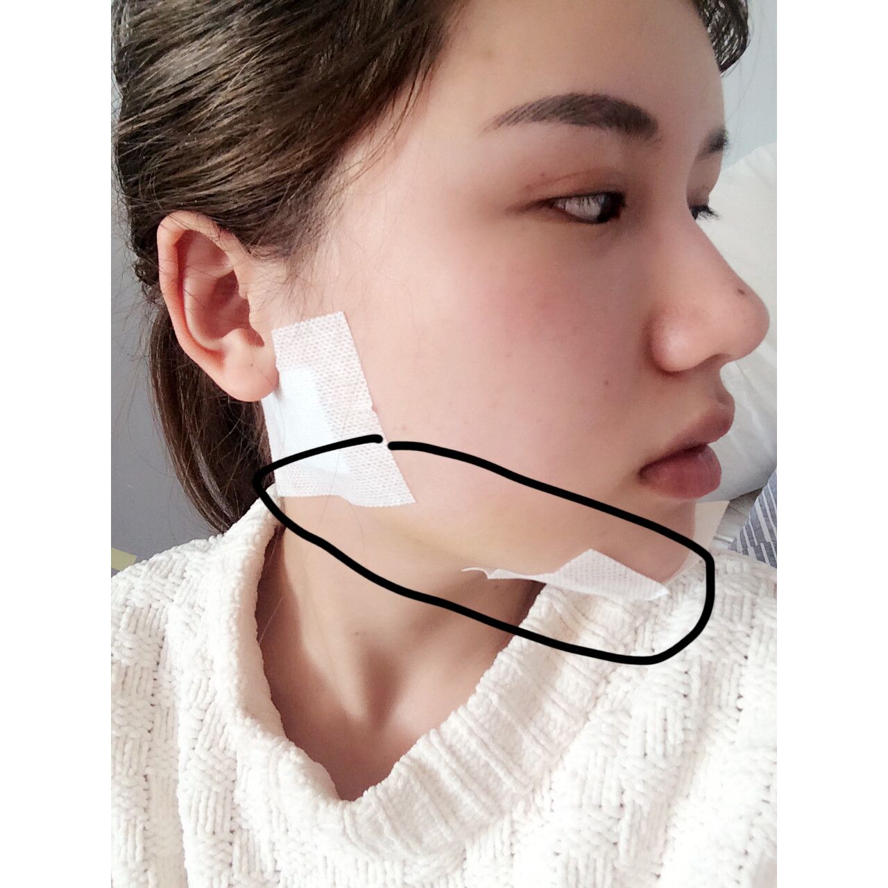 双下巴拍不出来啊,总之就是低头没有了,腮帮子的肥肉也没有了,现在就