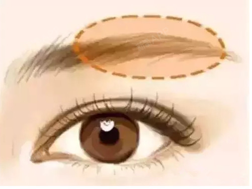 你适合欧式双眼皮吗?眼睛是脸部重要的部位_圈子-新氧美容整形