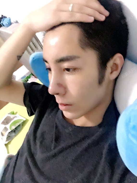 刘泽雨鼻部修复第35天美丽日记-新氧美容整形