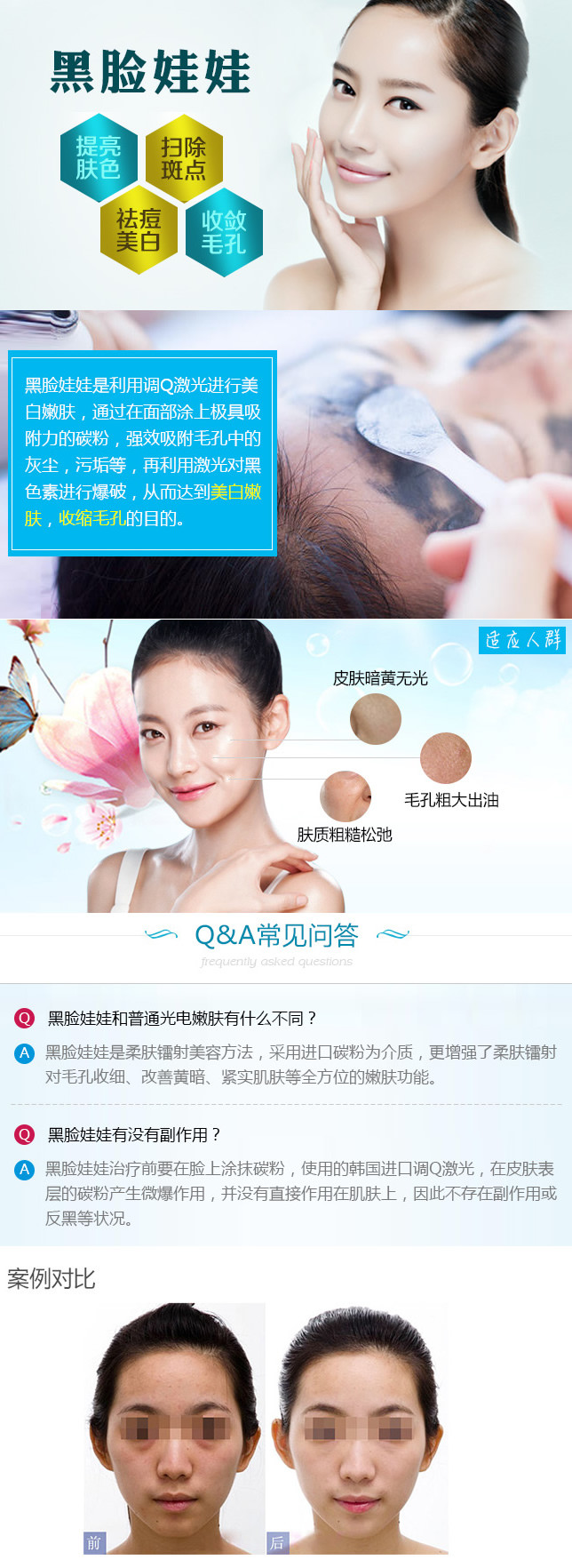 【黑脸娃娃】以黑焕白 解决毛孔黑头皮肤粗糙 嫩白透亮