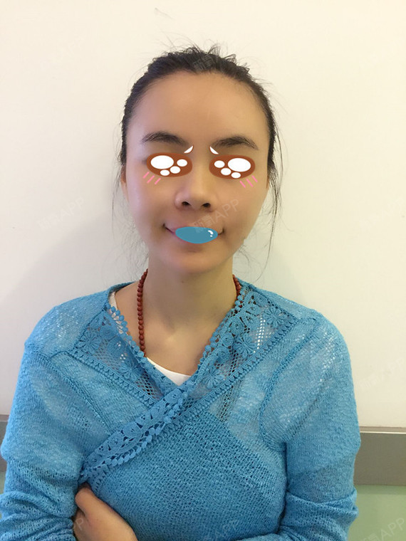 今天术后十天了,来两张照片给大家看看,朋友都说恢复得很好