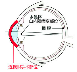 新氧 - 氧气姐 | 眼部 | 北京同城 | 名医直通车 新氧 - 氧气姐 | 眼部 | 北京同城 | 名医直通车