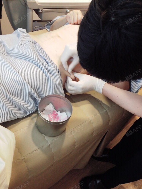 他今天在美尔韩医院做了瘦身埋线