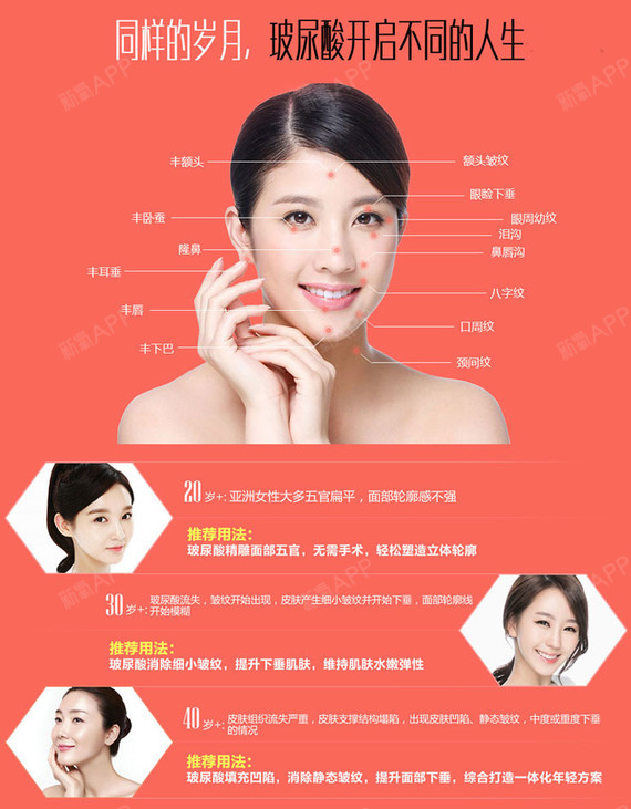 【玻尿酸】【润百颜星耀】主任专家注射,四维微雕塑形