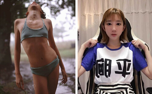 新氧 - SUJINCHOI | 美容美妆 | 胸部 | 隆胸 | 假体隆胸 | 自体脂肪隆胸 | 韩国整形 新氧 - SUJINCHOI | 美容美妆 | 胸部 | 隆胸 | 假体隆胸 | 自体脂肪隆胸 | 韩国整形