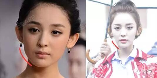 倪妮的也是咬肌miss,脸小了一圈.