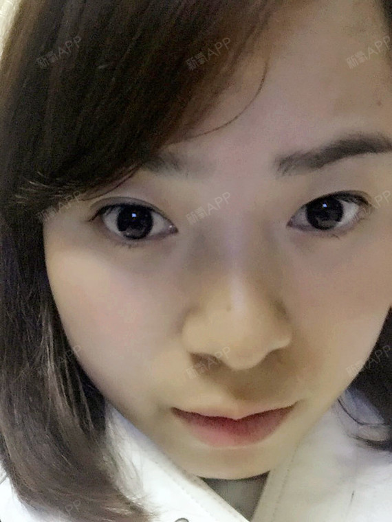 美瞳线第5天,感觉都掉完了,然后微信问了给我纹眼线