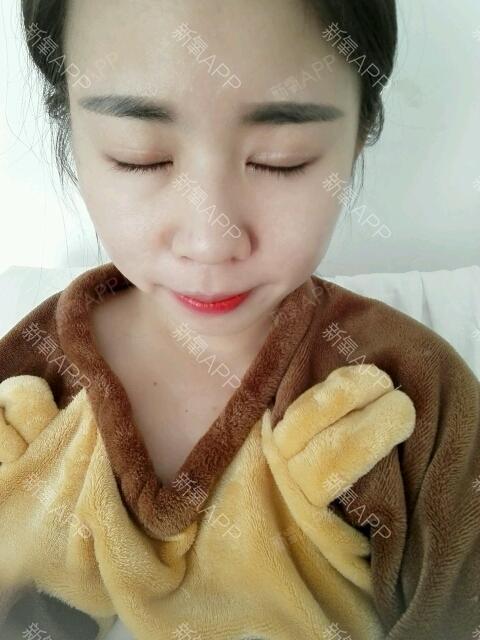 默默_519697第8天美丽日记-新氧美容整形