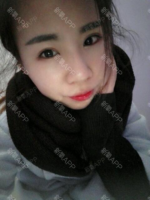 默默_519697第8天美丽日记-新氧美容整形